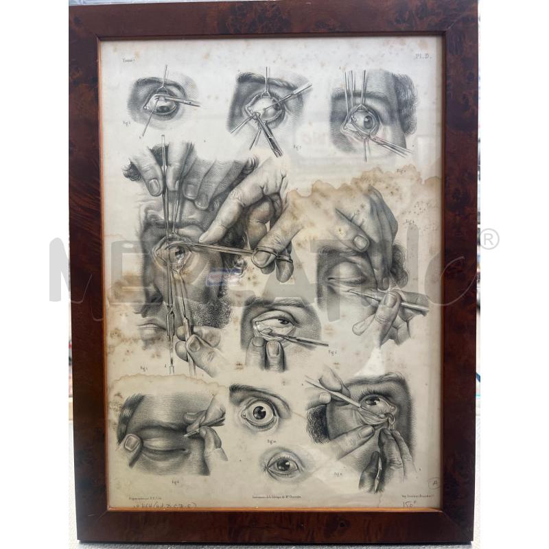 TAVOLA ANATOMICA CHIRURGICA OFTALMICA 49X37 JACOB | Mercatino dell'Usato San giovanni teatino 1