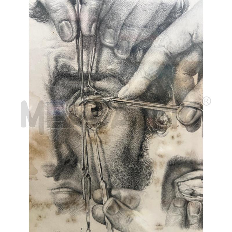 TAVOLA ANATOMICA CHIRURGICA OFTALMICA 49X37 JACOB | Mercatino dell'Usato San giovanni teatino 2
