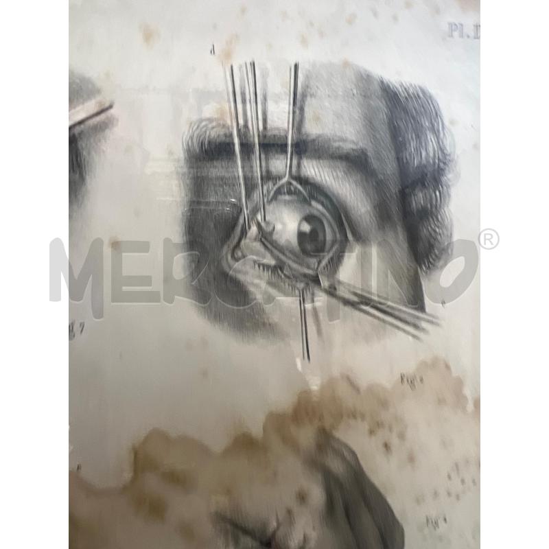 TAVOLA ANATOMICA CHIRURGICA OFTALMICA 49X37 JACOB | Mercatino dell'Usato San giovanni teatino 3