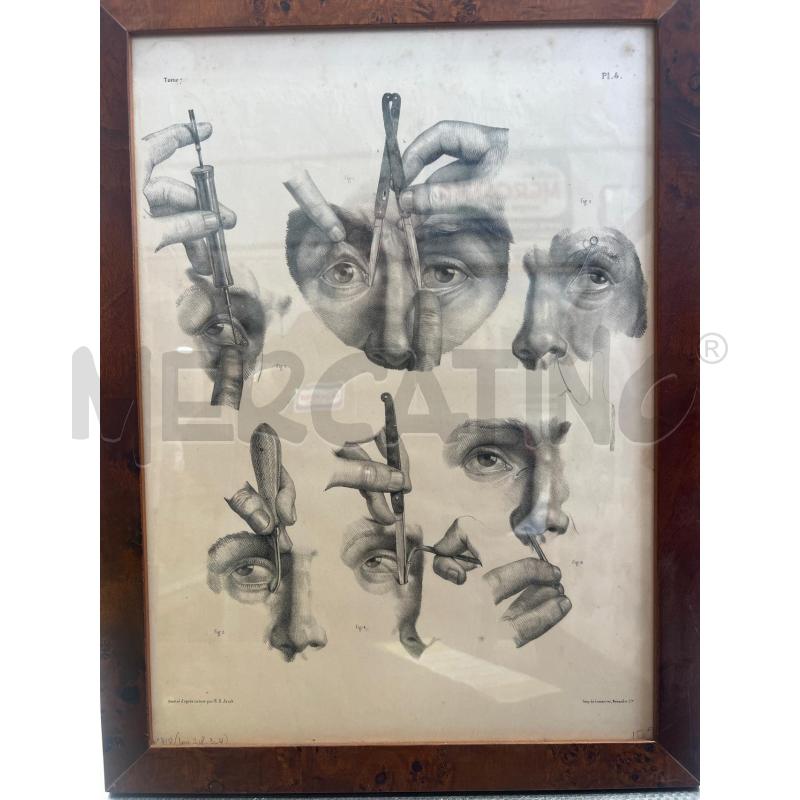 TAVOLA ANATOMICA CHIRURGICA OFTALMICA 49X37 JACOB | Mercatino dell'Usato San giovanni teatino 1