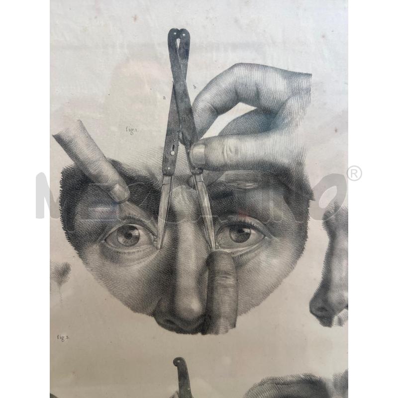 TAVOLA ANATOMICA CHIRURGICA OFTALMICA 49X37 JACOB | Mercatino dell'Usato San giovanni teatino 2