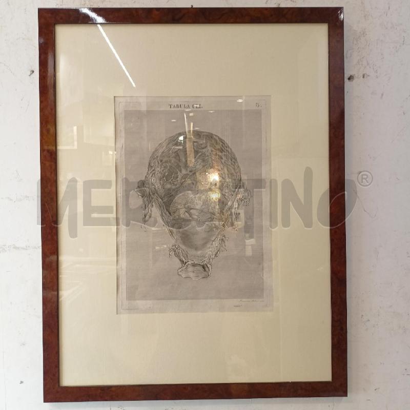 QUADRO INC ANATOMICO UTERO CORN RADICA  | Mercatino dell'Usato Roma re di roma 1