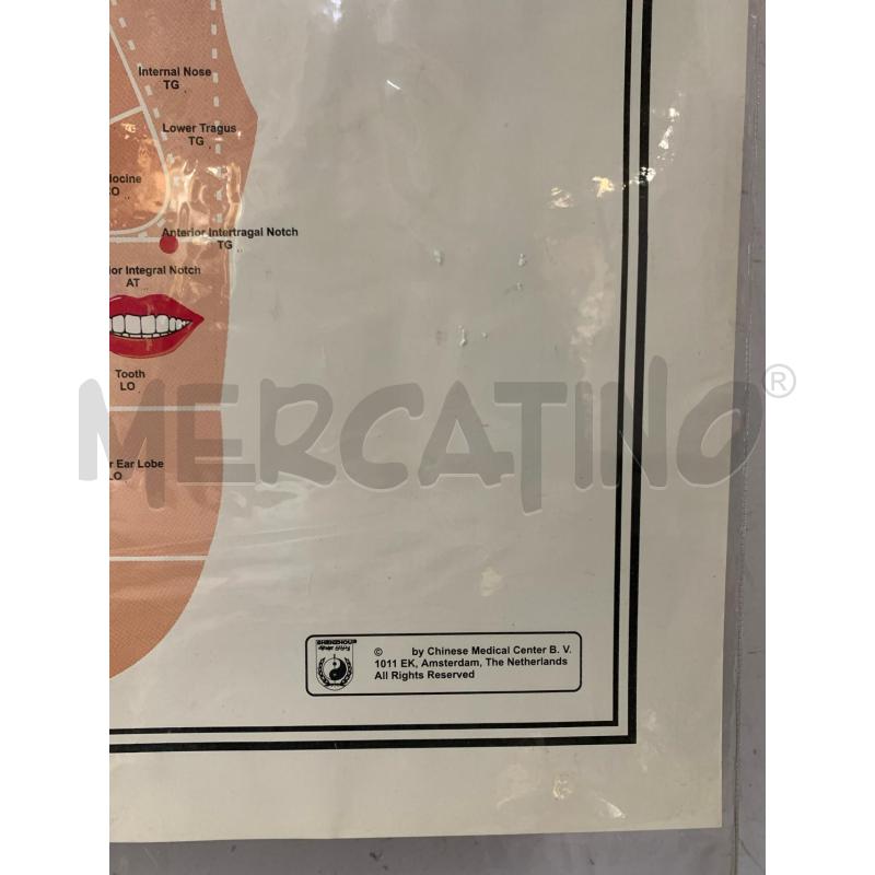 QUADRO STAMPA AGOPUNTURA ORECCHIO  | Mercatino dell'Usato Roma re di roma 2